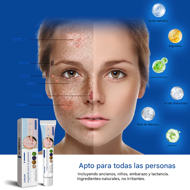 🔥( PROMO 2x1 )Crema para el tratamiento de la piel con veneno de abeja - LOVILDS™🔥